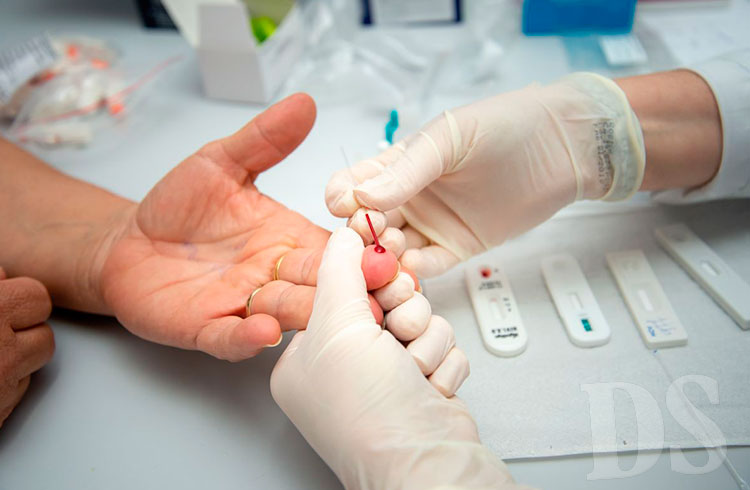 Testes rápidos detectam os anticorpos contra o HIV